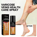Varicose Veins Spray – Natural Herbal Formula for Fast Relief