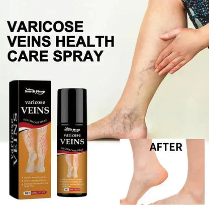 Varicose Veins Spray – Natural Herbal Formula for Fast Relief I Buy 1 Get 1 Free