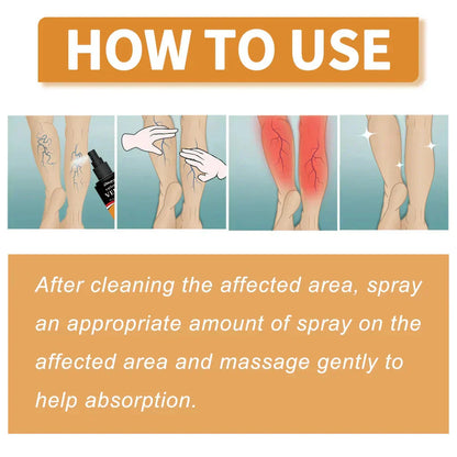 Varicose Veins Spray – Natural Herbal Formula for Fast Relief I Buy 1 Get 1 Free