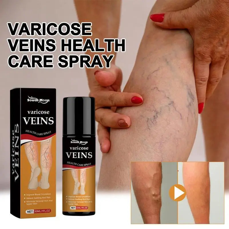 Varicose Veins Spray – Natural Herbal Formula for Fast Relief I Buy 1 Get 1 Free