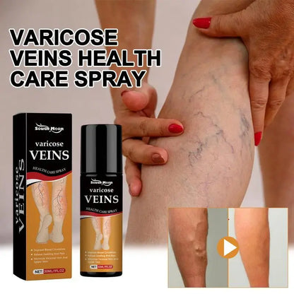 Varicose Veins Spray – Natural Herbal Formula for Fast Relief I Buy 1 Get 1 Free